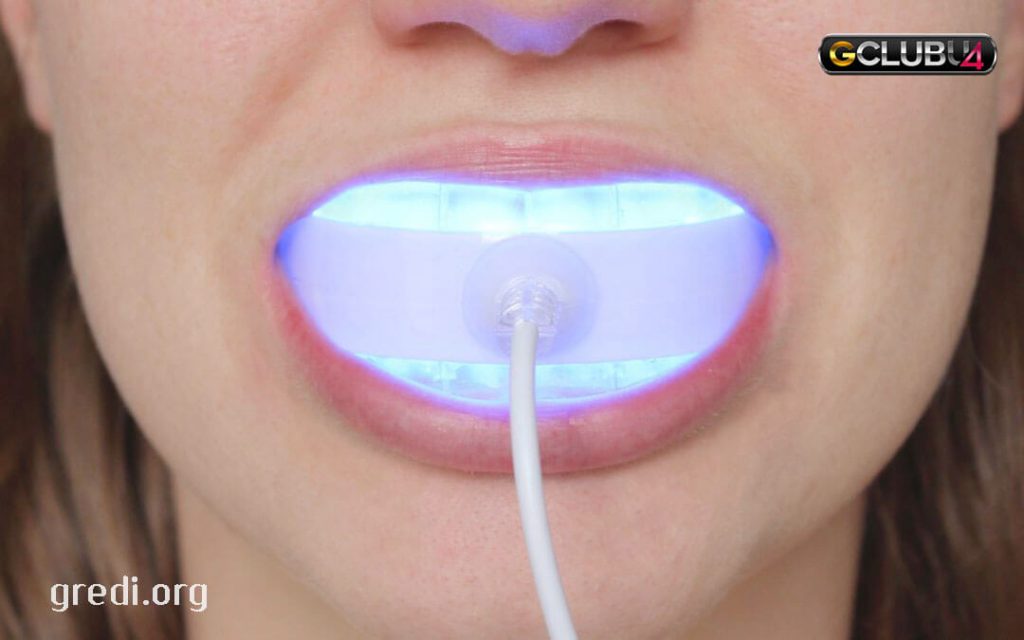 3D White Whitestrips with Light Teeth Whitening Kit